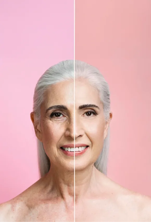Old and youthful skin comparison