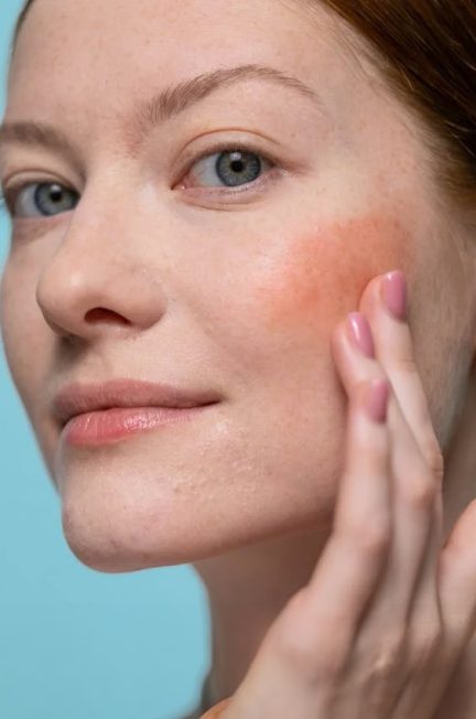 Woman-applying-product-on-her-face