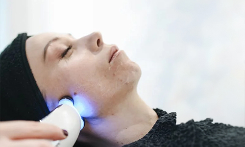 Skincare-treatment