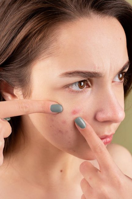 Woman with breakouts